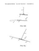 OVER-THE-WIRE CARDIAC IMPLANT DELIVERY SYSTEM FOR TREATMENT OF CHF AND     OTHER CONDITIONS diagram and image