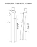 OVER-THE-WIRE CARDIAC IMPLANT DELIVERY SYSTEM FOR TREATMENT OF CHF AND     OTHER CONDITIONS diagram and image