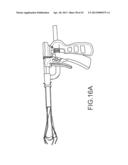 OVER-THE-WIRE CARDIAC IMPLANT DELIVERY SYSTEM FOR TREATMENT OF CHF AND     OTHER CONDITIONS diagram and image