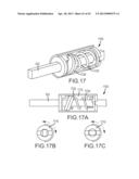 OVER-THE-WIRE CARDIAC IMPLANT DELIVERY SYSTEM FOR TREATMENT OF CHF AND     OTHER CONDITIONS diagram and image