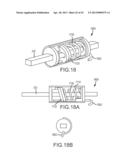 OVER-THE-WIRE CARDIAC IMPLANT DELIVERY SYSTEM FOR TREATMENT OF CHF AND     OTHER CONDITIONS diagram and image