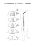 ATHERECTOMY APPARATUS, SYSTEMS AND METHODS diagram and image