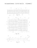 ATHERECTOMY APPARATUS, SYSTEMS AND METHODS diagram and image