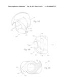 ATHERECTOMY APPARATUS, SYSTEMS AND METHODS diagram and image