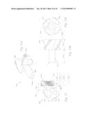 ATHERECTOMY APPARATUS, SYSTEMS AND METHODS diagram and image