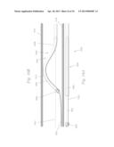 ATHERECTOMY APPARATUS, SYSTEMS AND METHODS diagram and image