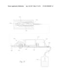 ATHERECTOMY APPARATUS, SYSTEMS AND METHODS diagram and image