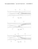 ATHERECTOMY APPARATUS, SYSTEMS AND METHODS diagram and image