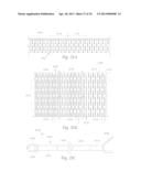 ATHERECTOMY APPARATUS, SYSTEMS AND METHODS diagram and image