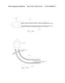 ATHERECTOMY APPARATUS, SYSTEMS AND METHODS diagram and image