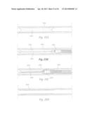 ATHERECTOMY APPARATUS, SYSTEMS AND METHODS diagram and image