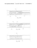 ATHERECTOMY APPARATUS, SYSTEMS AND METHODS diagram and image