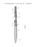 ATHERECTOMY CATHETERS AND NON-CONTACT ACTUATION MECHANISM FOR CATHETERS diagram and image