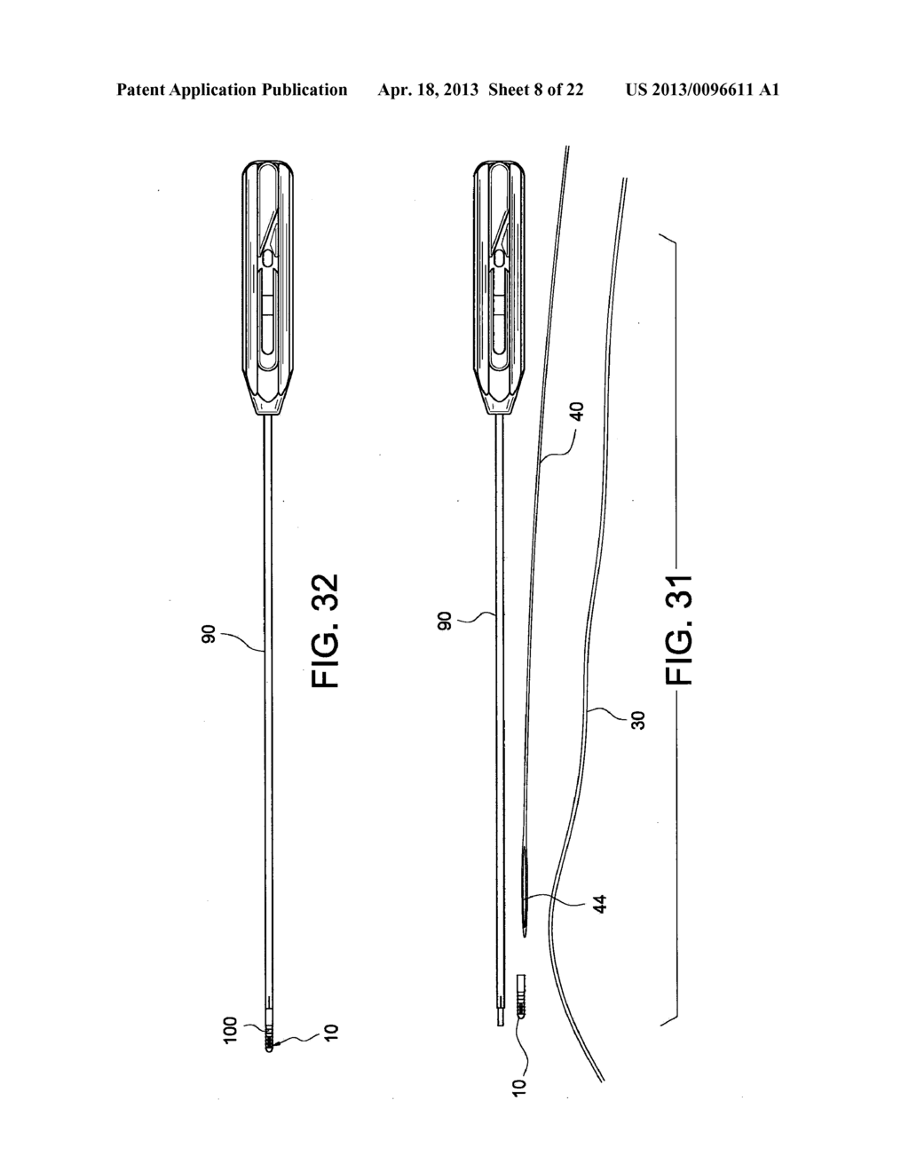 TENSIONABLE KNOTLESS ANCHORS WITH SPLICE AND METHODS OF TISSUE REPAIR - diagram, schematic, and image 09