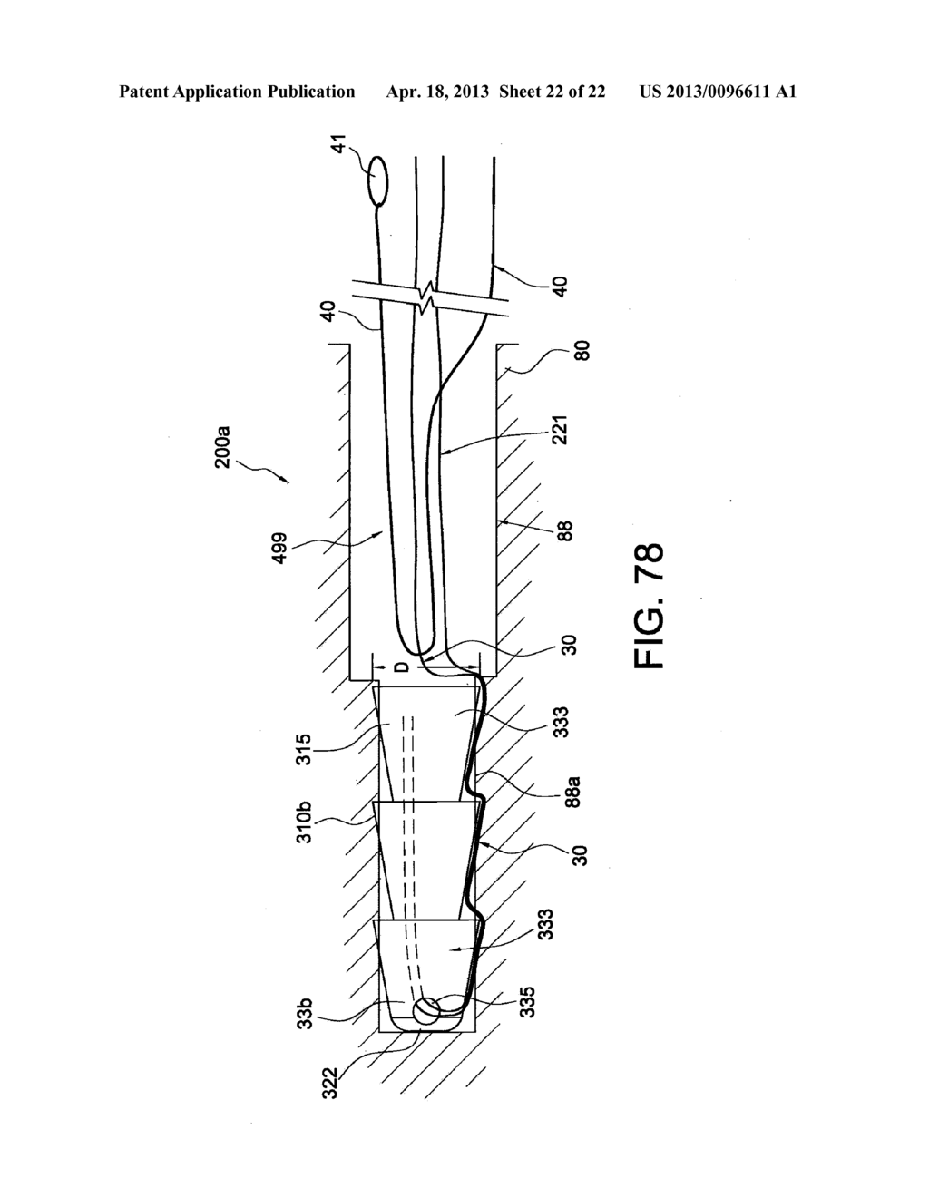 TENSIONABLE KNOTLESS ANCHORS WITH SPLICE AND METHODS OF TISSUE REPAIR - diagram, schematic, and image 23