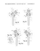 POLYAXIAL BONE ANCHORING DEVICE WITH ENLARGED PIVOT ANGLE diagram and image