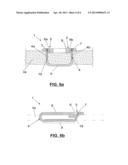 FIXATION DEVICE FOR THE FIXATION OF BONE FRAGMENTS diagram and image