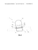 FIXATION DEVICE FOR THE FIXATION OF BONE FRAGMENTS diagram and image