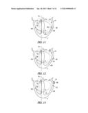 VENTRICULAR PACING diagram and image