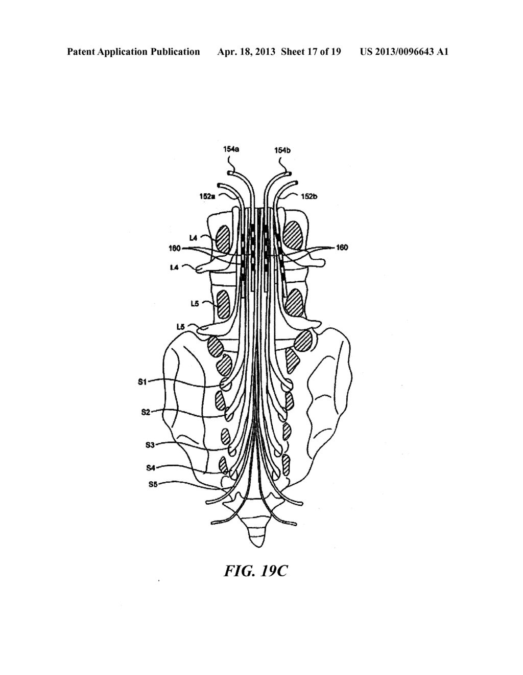 MULTI-FREQUENCY NEURAL TREATMENTS AND ASSOCIATED SYSTEMS AND METHODS - diagram, schematic, and image 18