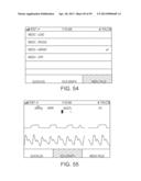 SYSTEMS AND METHODS FOR EMS DEVICE COMMUNICATION INTERFACE diagram and image