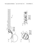 Charger Alignment in an Implantable Medical Device System Employing     Reflected Impedance Modulation diagram and image