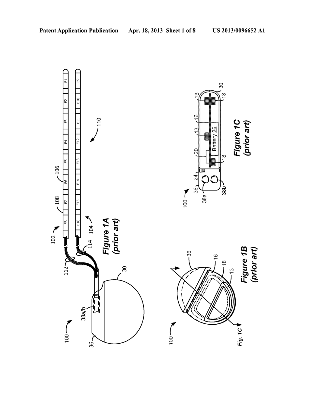 Closed Loop Charger for an Implantable Medical Device System Employing     Reflected Impedance Modulation - diagram, schematic, and image 02