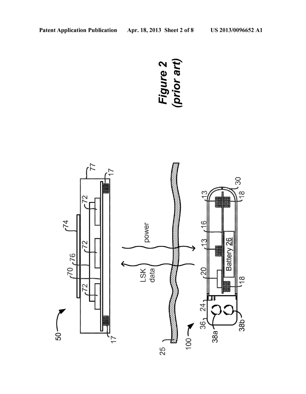 Closed Loop Charger for an Implantable Medical Device System Employing     Reflected Impedance Modulation - diagram, schematic, and image 03