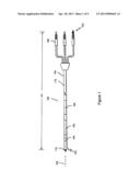 ATRAUMATIC LEAD REMOVAL SHEATH diagram and image