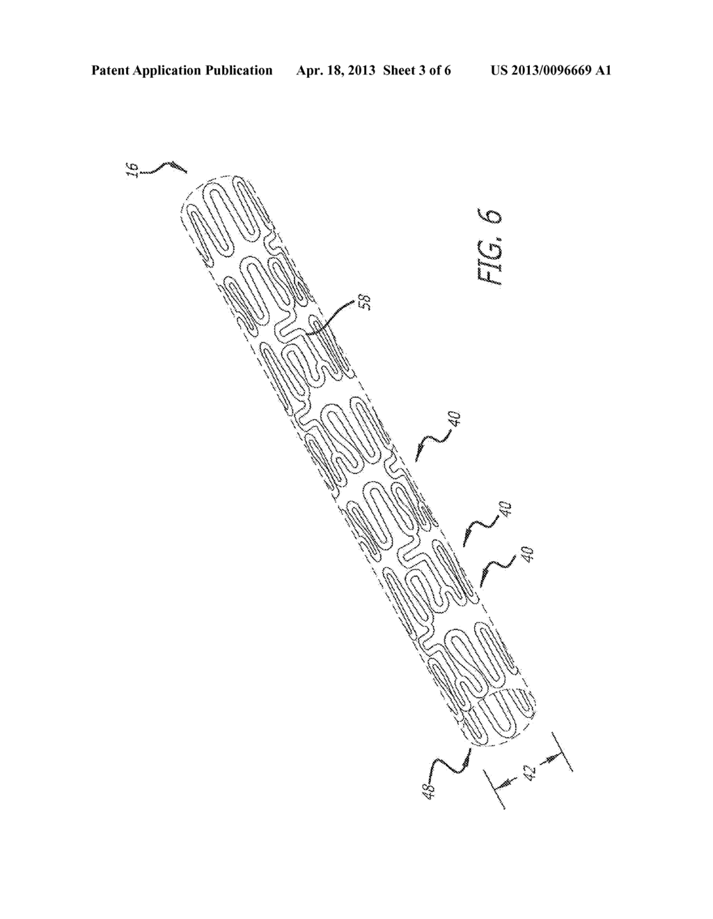 PARTIALLY ANNEALED STENT - diagram, schematic, and image 04