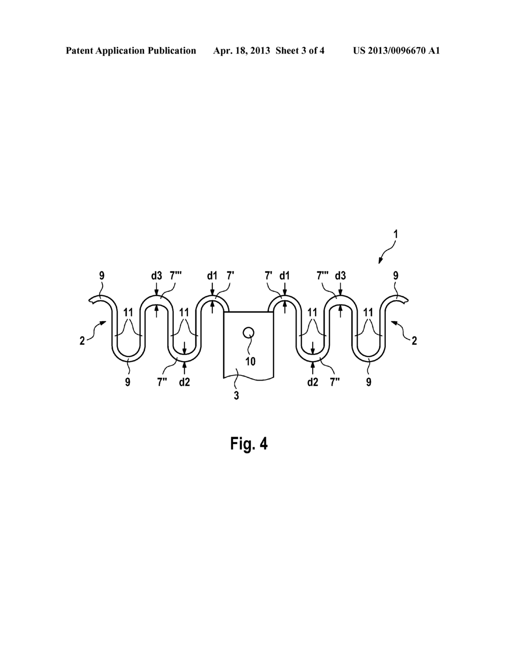 Expandable Medical Implant - diagram, schematic, and image 04