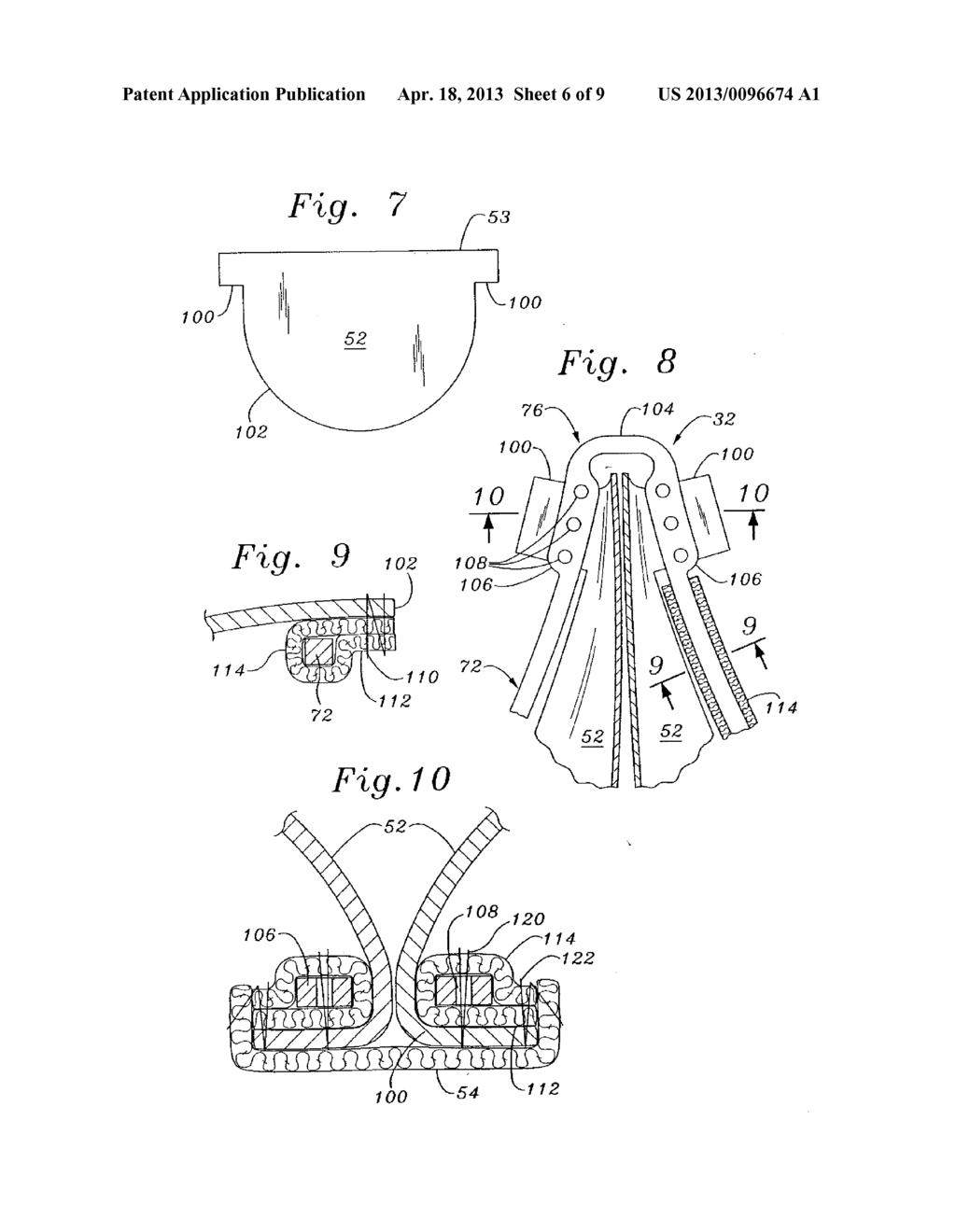 MINIMALLY-INVASIVE PROSTHETIC HEART VALVE METHOD - diagram, schematic, and image 07