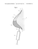 BODY PART SHAPED MOULD AND A METHOD FOR USING SUCH A MOULD diagram and image