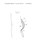 BODY PART SHAPED MOULD AND A METHOD FOR USING SUCH A MOULD diagram and image