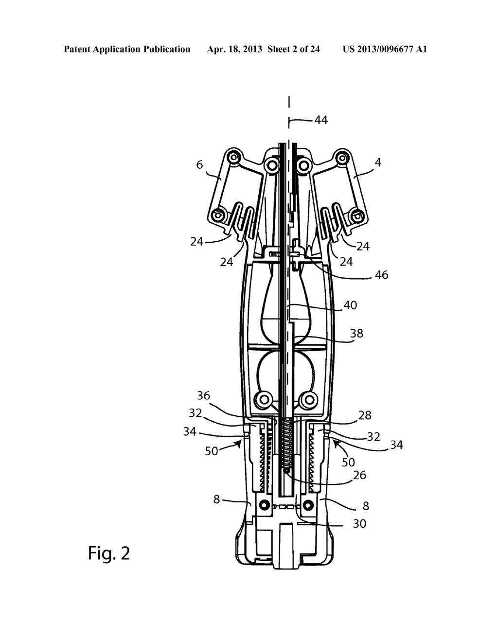 ACL IMPLANTS, INSTRUMENTS, AND METHODS - diagram, schematic, and image 03