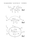 Method and Apparatus for Attaching Soft Tissue to Bone diagram and image