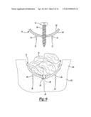 Method and Apparatus for Attaching Soft Tissue to Bone diagram and image