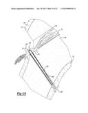 Method and Apparatus for Attaching Soft Tissue to Bone diagram and image