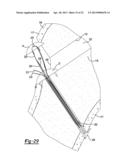 Method and Apparatus for Attaching Soft Tissue to Bone diagram and image