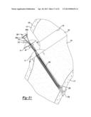 Method and Apparatus for Attaching Soft Tissue to Bone diagram and image