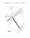 Method and Apparatus for Attaching Soft Tissue to Bone diagram and image