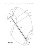 Method and Apparatus for Attaching Soft Tissue to Bone diagram and image