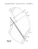 Method and Apparatus for Attaching Soft Tissue to Bone diagram and image