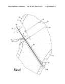 Method and Apparatus for Attaching Soft Tissue to Bone diagram and image