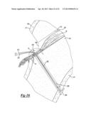 Method and Apparatus for Attaching Soft Tissue to Bone diagram and image