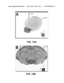 ESTIMATION OF NEURAL RESPONSE FOR OPTICAL STIMULATION diagram and image