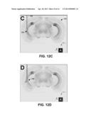 ESTIMATION OF NEURAL RESPONSE FOR OPTICAL STIMULATION diagram and image