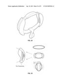 ELASTIC LOAD SUSPENSION diagram and image