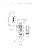 LACE JOINING AND EXCHANGING SYSTEM diagram and image