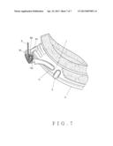 MEANS TO SECURE A LENS INTO LENS FRAME OF A SNOW GOGGLE diagram and image